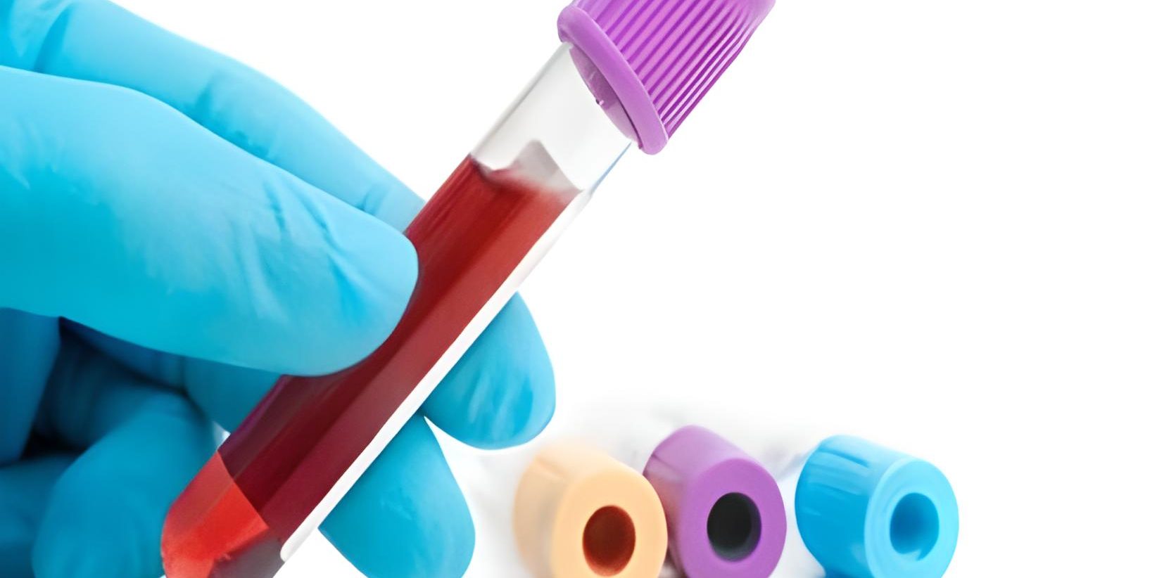 Was sollte der E2-Hormonwert bei der IVF-Behandlung sein