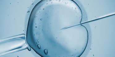 Ist ICSI für IVF Notwendig