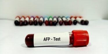 Was ist der Afp-Test