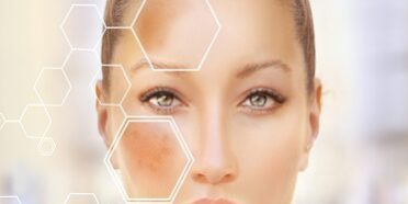 Wie lange hält die Pigmentierung während der Schwangerschaft an