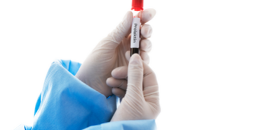 Was ist ein Prolaktin-Hormon