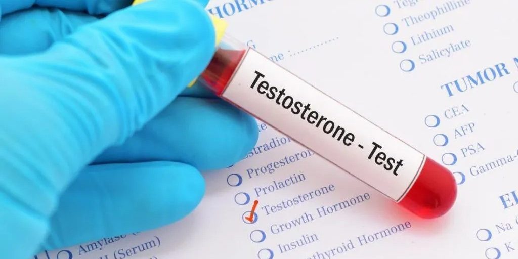 Was ist Testostoron-Hormon
