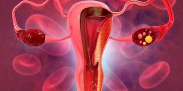 Was ist eine vorzeitige Ovarialinsuffizienz (POF)