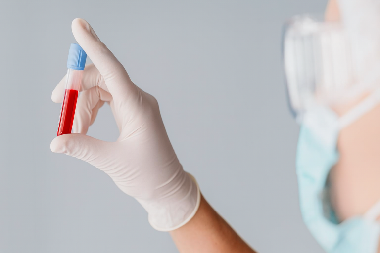 beeinflussen-intravenose-immunglobuline-ivig-die-ivf-behandlung Beeinflussen intravenöse Immunglobuline (IVIG) die IVF-Behandlung