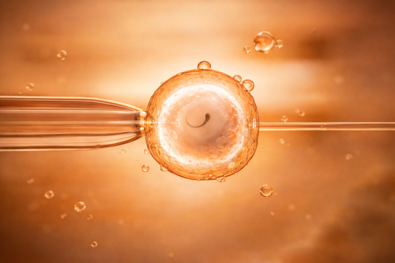 IVF Behandlung Schritt für Schritt